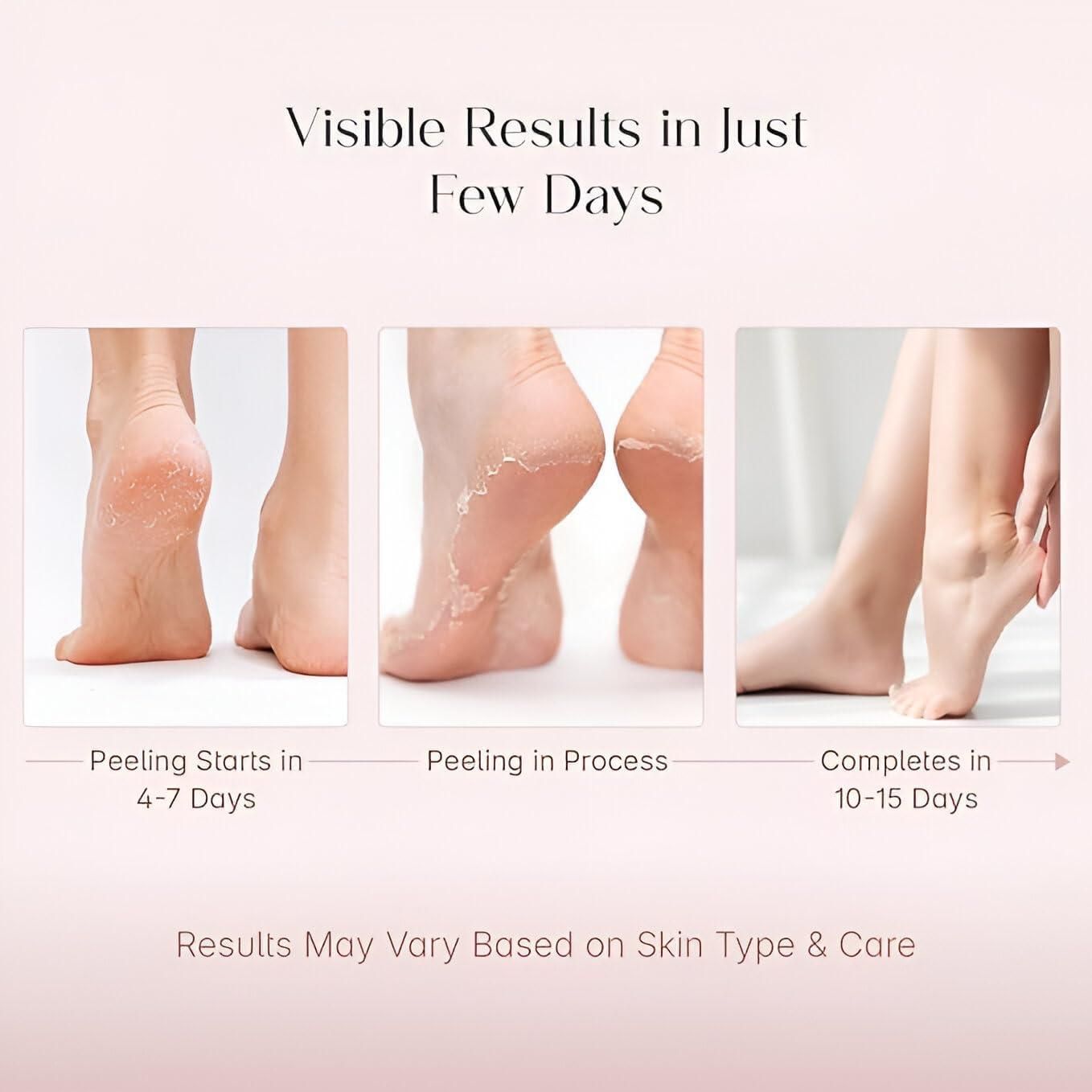 Exfoliating Foot Mask – Peel Away Dry, Rough & Dead Skin Naturally (Combo)