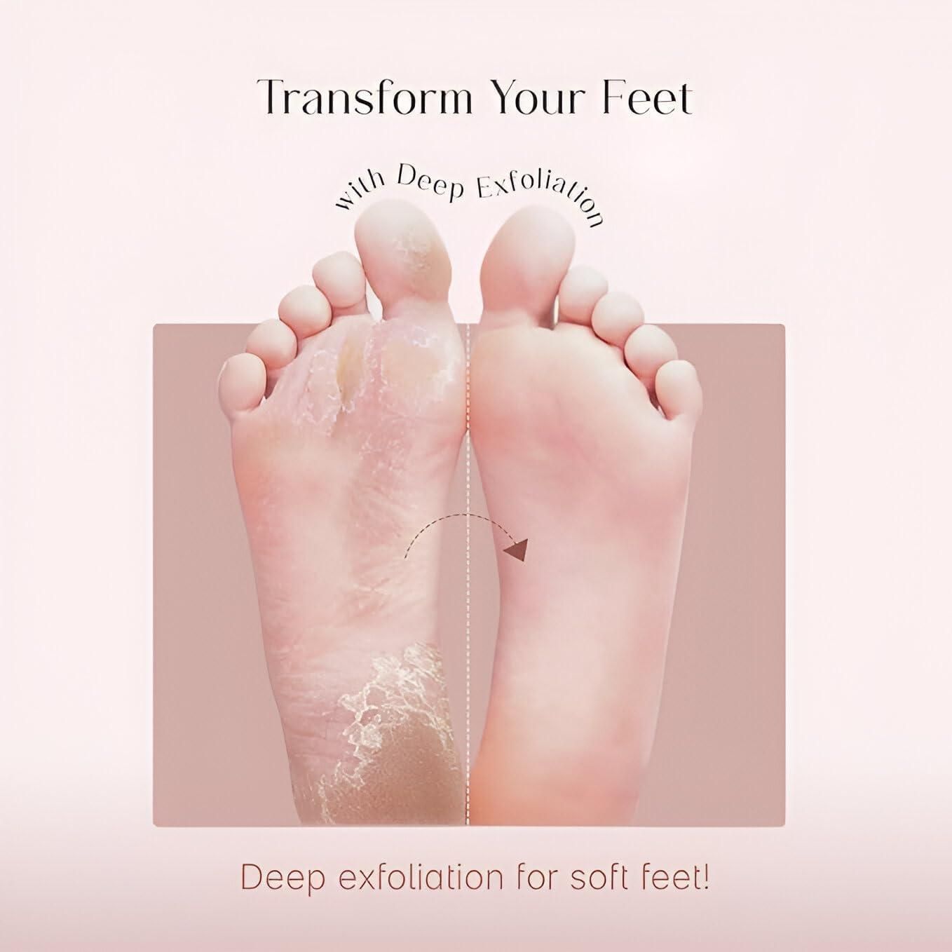 Exfoliating Foot Mask – Peel Away Dry, Rough & Dead Skin Naturally (Combo)