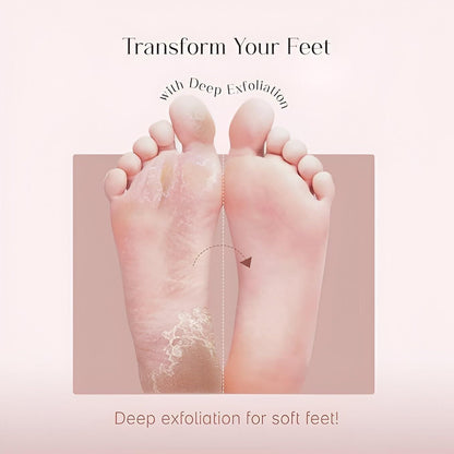 Exfoliating Foot Mask – Peel Away Dry, Rough & Dead Skin Naturally (Combo)
